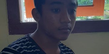Fasrim (14) korban penganiayaan. (Foto Risto)