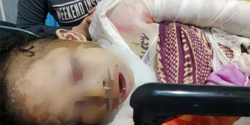 Korban R Saat Dirawat Di RSUD Labuha