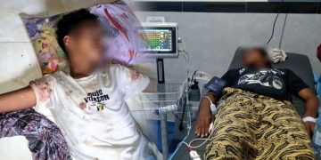 Korban Safrudin dan Samsudin saat di rawat di RSUD Labuha